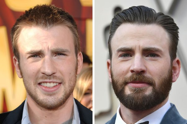 Hollywood's Dirty Little Secret- Why Everyone's Losing Their Hair (And Their Minds)